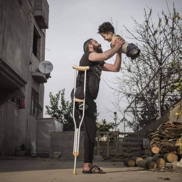 獨腳父親抱起無四肢兒子的燦笑 奪最佳攝影獎