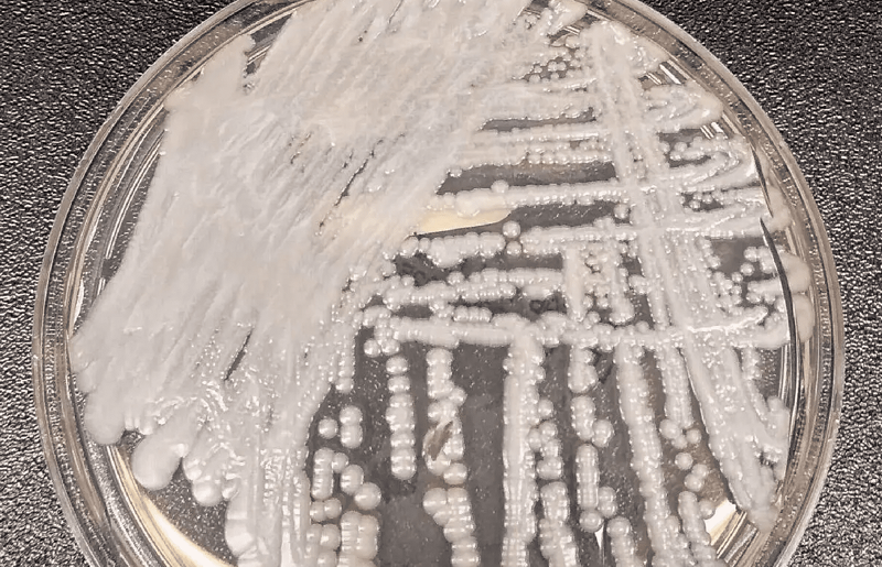 內州南部「超級細菌」病例創歷史新高