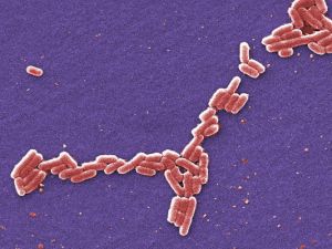 墨西哥湾出现致命病菌 致死率50％